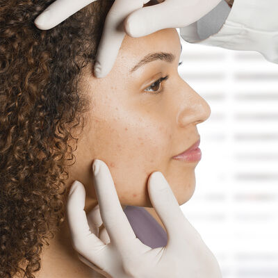 How to Get Clearer Skin